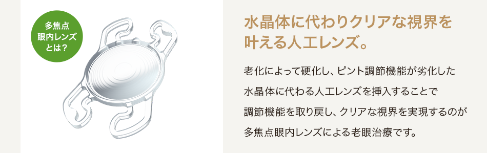 水晶体に代わりクリアな視界を叶える人工レンズ。老化によって硬化し、ピント調節機能が劣化した水晶体に代わる人工レンズを挿入することで調節機能を取り戻し、クリアな視界を実現するのが多焦点眼内レンズによる老眼治療です。