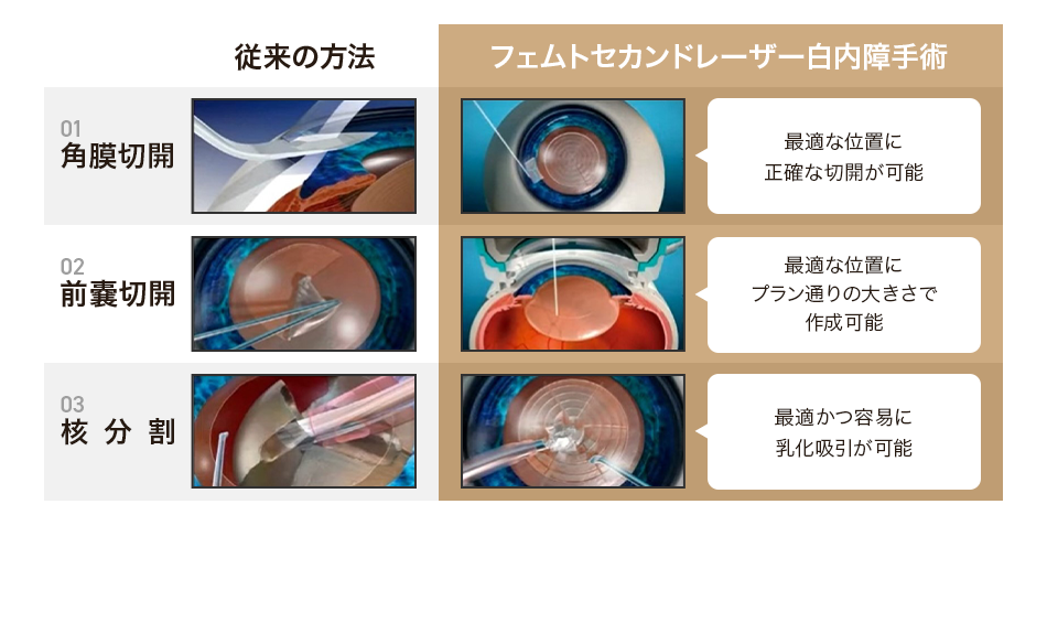 フェムトセカンドレーザー白内障手術 角膜切開 最適な位置に正確な切開が可能 前嚢切開 最適な位置にプラン通りの大きさで作成可能 核分割 最適かつ容易に乳化吸引が可能