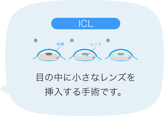 ICLの説明