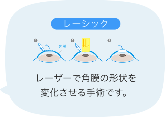 レーシックの説明
