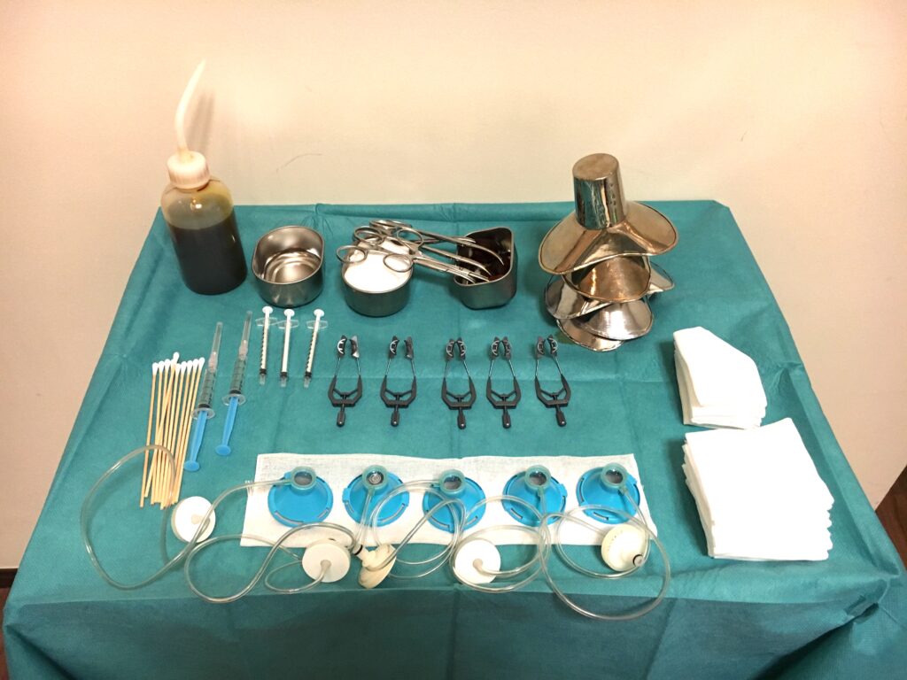フェムトセカンドレーザー白内障手術時に展開する器具。