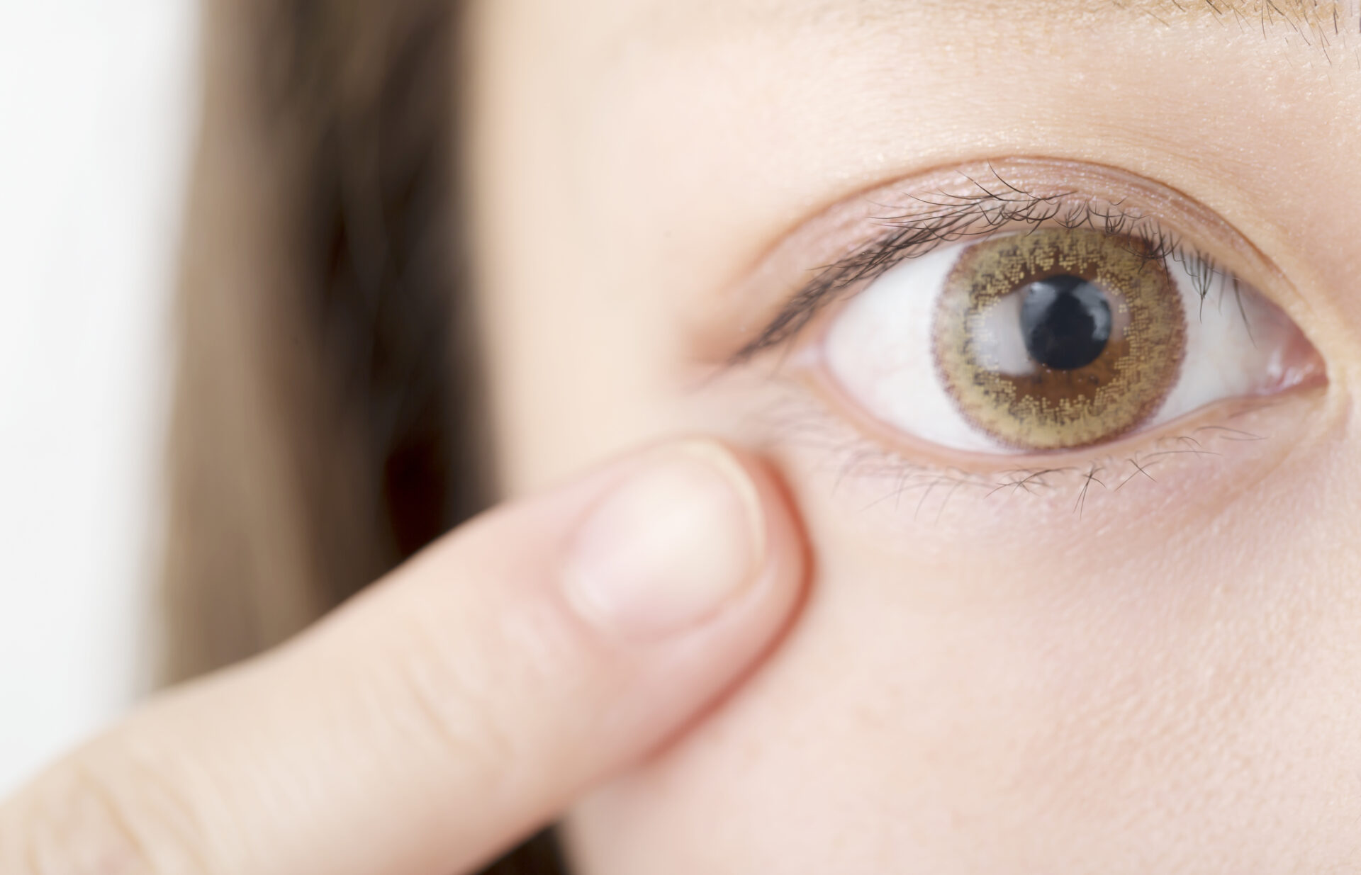 正常眼圧緑内障の症状